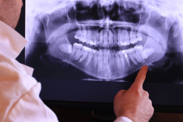 Best Emergency Treatment for Dental Infections or Abscesses in Magnolia, TX